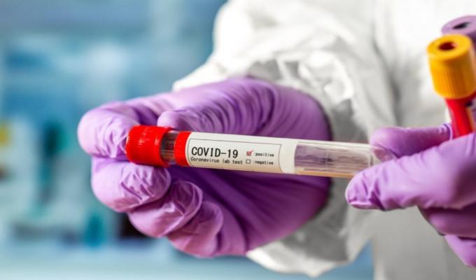 В Попаснянському районі протягом тижня зафіксовано 62 нових випадки COVID-19 В Попаснянському районі протягом тижня зафіксовано 62 нових випадки COVID-19