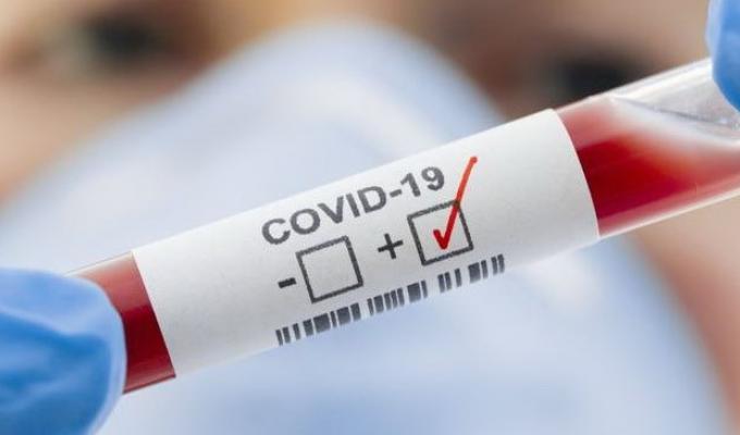 Фіксуються нові випадки COVID-19 Фіксуються нові випадки COVID-19
