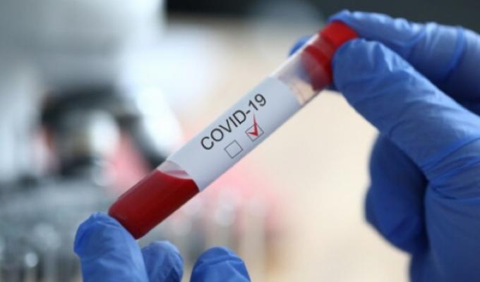 Лабораторно підтверджено ще 22 випадки COVID-19 в області Лабораторно підтверджено ще 22 випадки COVID-19 в області