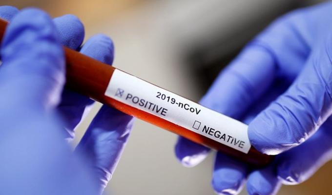 Тижнева епідситуація по Попаснянському району Тижнева епідситуація по Попаснянському району