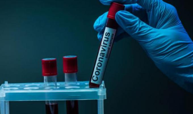 Лабораторно підтверджено три нових випадки COVID-19 в області Лабораторно підтверджено три нових випадки COVID-19 в області