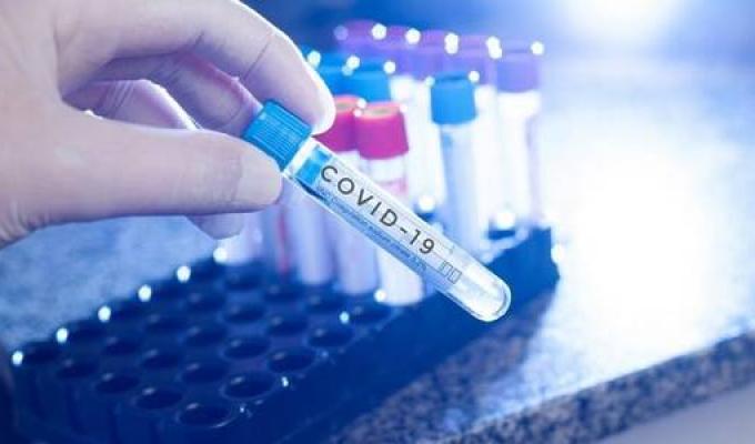 Лабораторно підтверджено 54 нових випадки COVID-19 в області Лабораторно підтверджено 54 нових випадки COVID-19 в області