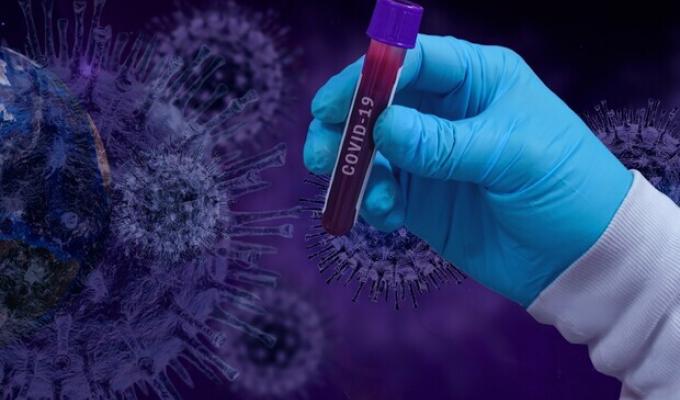 Лабораторно підтверджено 101 новий випадок COVID-19 в області Лабораторно підтверджено 101 новий випадок COVID-19 в області