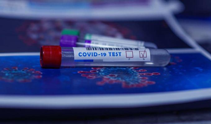 В районі нових випадків захворювання на COVID-19 не зафіксовано