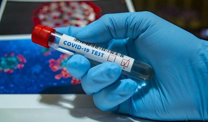 На Попаснянщині зафіксовано новий випадок захворювання на COVID-19 На Попаснянщині зафіксовано новий випадок захворювання на COVID-19