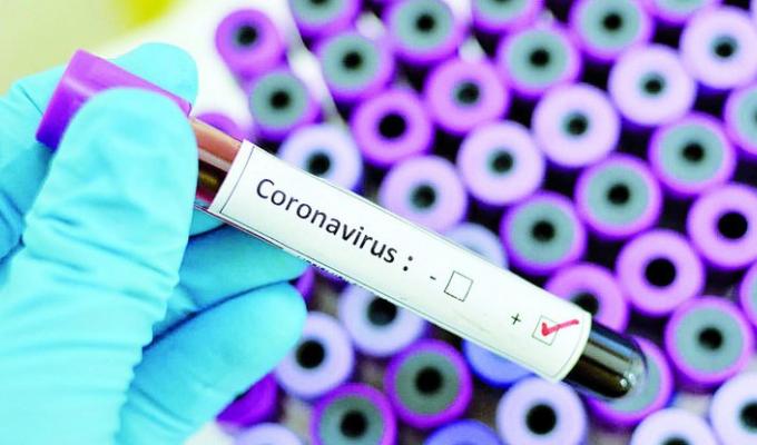 В області підтверджено новий випадок захворювання на COVID-19 В області підтверджено новий випадок захворювання на COVID-19