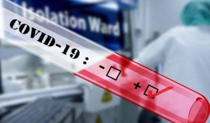 Лабораторно підтверджено 34 нових випадки COVID-19 в області Лабораторно підтверджено 34 нових випадки COVID-19 в області