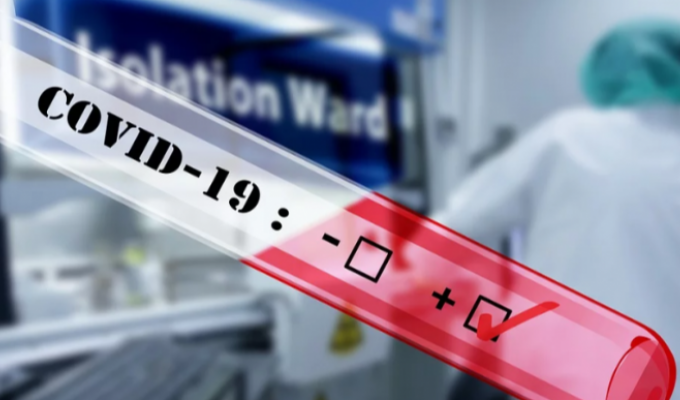 Лабораторно підтверджено 61 новий випадок COVID-19 в області Лабораторно підтверджено 61 новий випадок COVID-19 в області