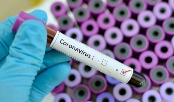Лабораторно підтверджено 161 новий випадок COVID-19 в області Лабораторно підтверджено 161 новий випадок COVID-19 в області