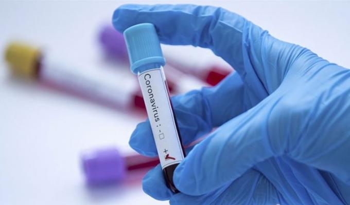 Лабораторно підтверджено 74 нових випадки COVID-19 в області Лабораторно підтверджено 74 нових випадки COVID-19 в області