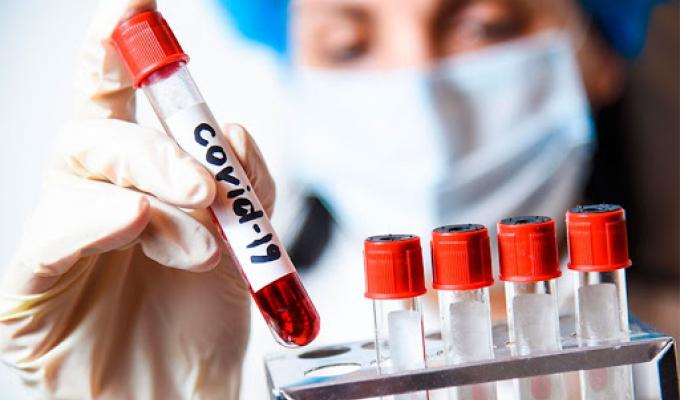 В районі зафіксовані нові випадки COVID-19 В районі зафіксовані нові випадки COVID-19