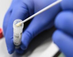 Лабораторно підтверджено 214 нових випадків COVID-19 в області. Від ускладнень померли ще три хворих