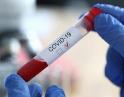 Лабораторно підтверджено 90 нових випадків COVID-19 в області. Від ускладнень померло ще чотири хворих