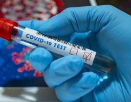 За останню добу на Луганщині лабораторно підтверджено 14 нових випадків COVID-19