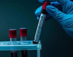 Лабораторно підтверджено 187 нових випадків COVID-19 в області. Від ускладнень померли ще чотири людини