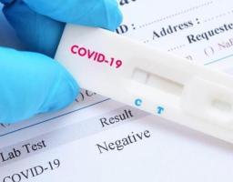 За минулу добу нових захворювань на COVID-19 в області не зафіксовано. Дві людини одужали