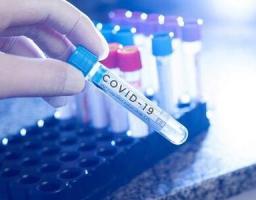 Лабораторно підтверджено 54 нових випадки COVID-19 в області