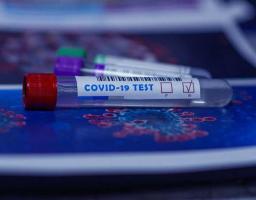В районі нових випадків захворювання на COVID-19 не зафіксовано