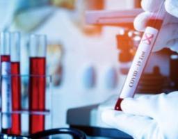 За минулу добу в Попаснянському районі зафіксовано чотири нові випадки захворювання на COVID-19