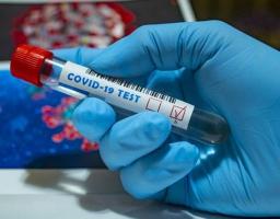 На Попаснянщині зафіксовано новий випадок захворювання на COVID-19