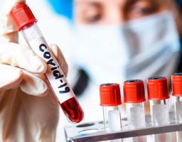 В районі зафіксовані нові випадки COVID-19