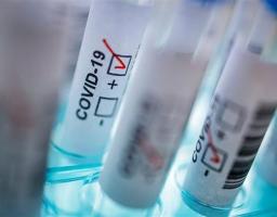 Лабораторно підтверджено 77 нових випадків COVID-19 в області